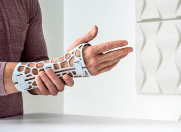 3D Druck