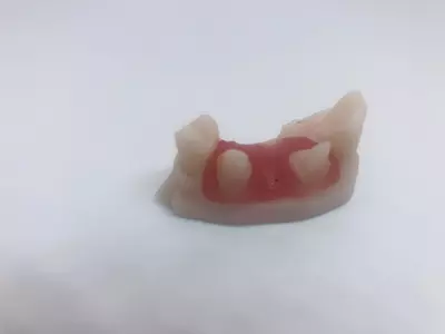 Vorderes Brückenmodell mit Weichgewebe